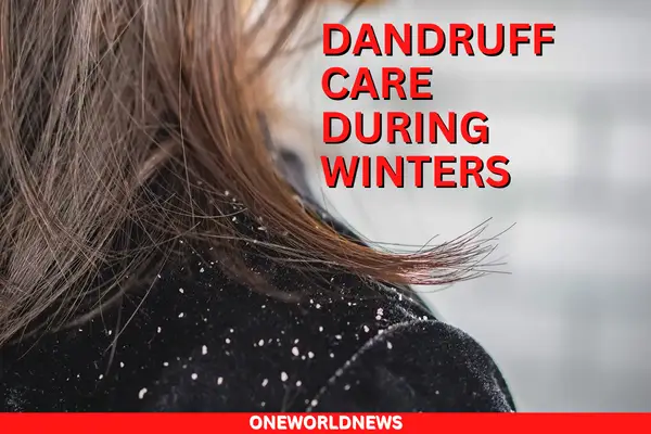 Dandruff Care During Winter