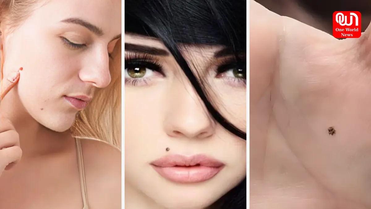 Lucky Moles In Body: भाग्यशाली होते हैं वो लाेग जिनके शरीर के इन हिस्सों पर होता है तिल, कभी नहीं होती पैसों की कमी 1 Lucky Moles In Body