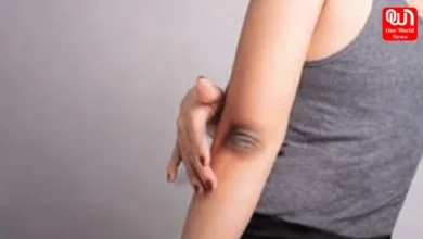 Dark Elbow And Knees Remedy