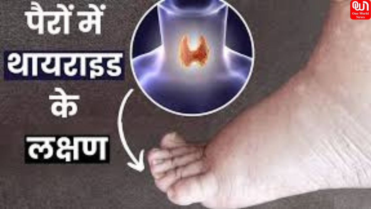 Symptoms of Thyroid On Feet: लगातार पैरों में दर्द और सूजन होना है थायराइड के लक्षण, अनदेखा करना पड़ सकता है सेहत पर भारी 1 Symptoms of Thyroid On Feet