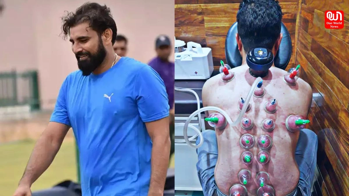Mohammed Shami : चोटों और दर्द को छू मंतर करें, मोहम्मद शमी के साथ जानिए क्रायोथेरेपी का जादू 1 Mohammed Shami