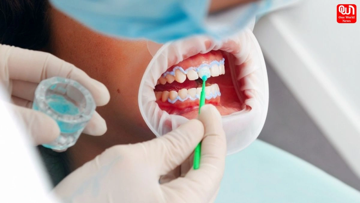 White Teeth Tips: टूथपेस्ट का गलत उपयोग कर सकता है दांतों को नुकसान, जानिए घरेलू उपाय 1 White Teeth Tips