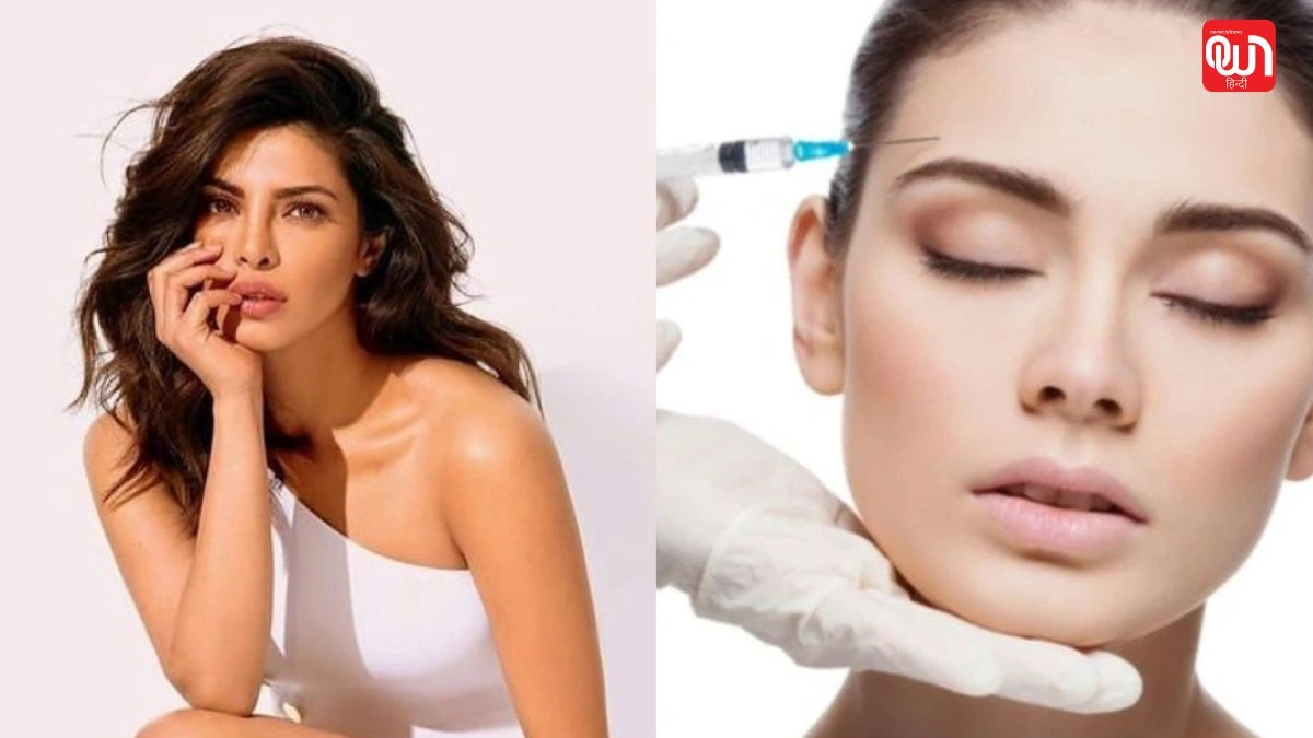 Anti-Ageing Treatment: झुर्रियों से छुटकारा और दमकती त्वचा, जानिए एंटी एजिंग ट्रीटमेंट के असर 1 Anti-Ageing Treatment