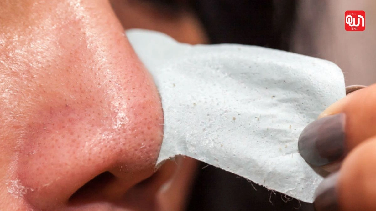 Blackheads: पार्लर छोड़ो, घर पर इन 3 चीजों से पाएं Blackheads से छुटकारा 1 Blackheads