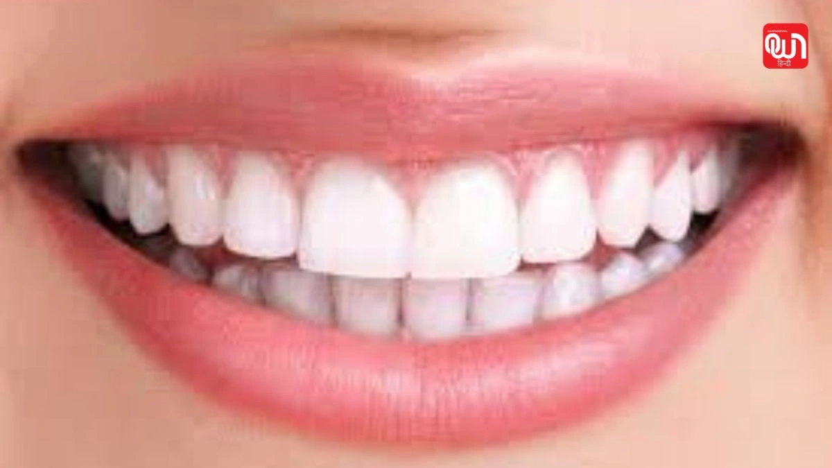 Free Dental Day: दांतों की सेहत और समाज की जिम्मेदारी, क्यों मनाया जाता है फ्री डेंटल डे? 1 Free Dental Day