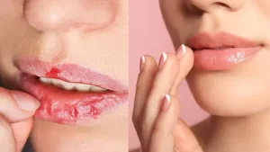 JOTBKHbHYmUbilezVQwd