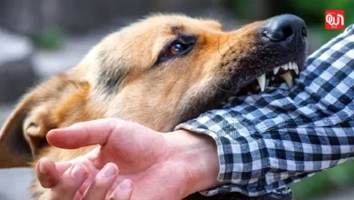 Dog bite Compensation: देश के इस राज्य में बड़ा एलान, डॉग बाइट और पशु हमले का मुआवजा तय 7 Dog bite Compensation