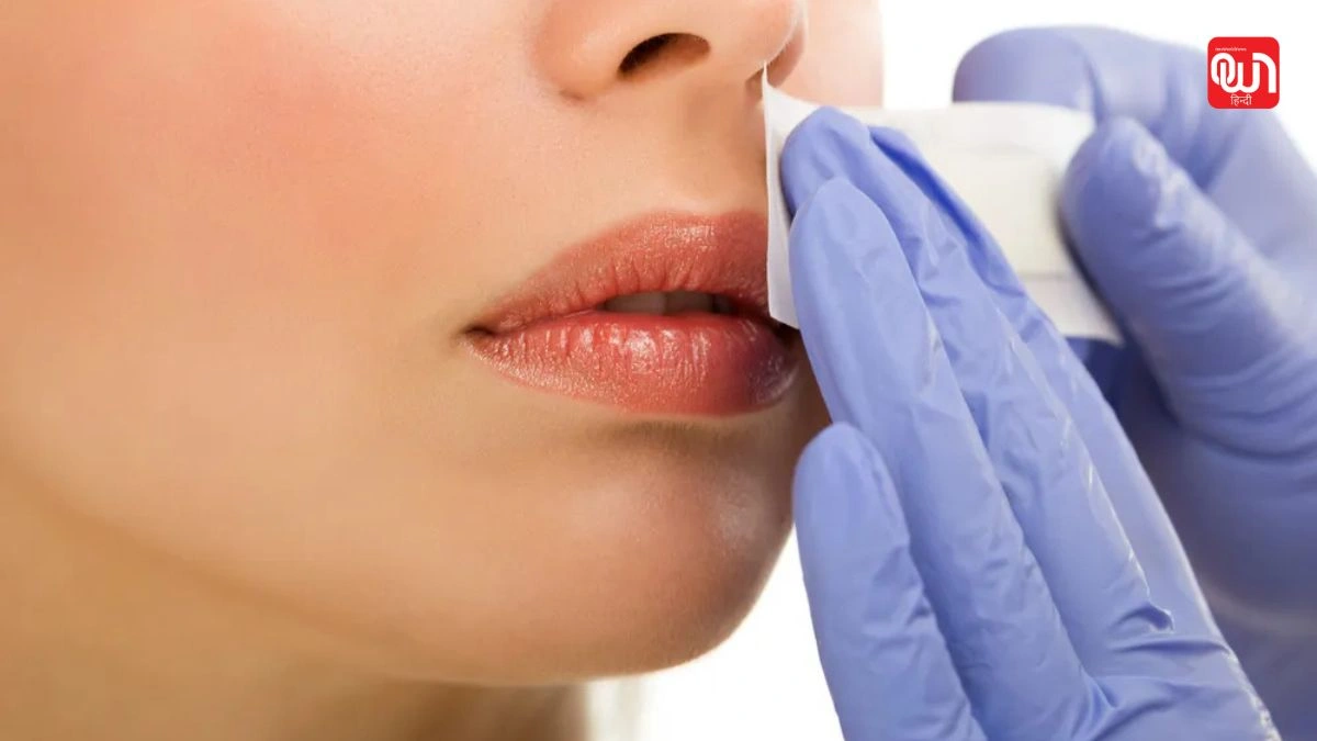 Upper lip hair remove: क्या बेसन से हट सकते हैं अपर लिप के बाल? एक्सपर्ट से मिली जरूरी जानकारी 1 Upper lip hair remove