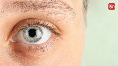 World Keratoconus Day