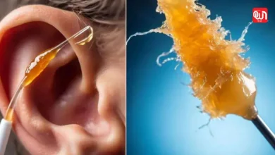 Clean Earwax