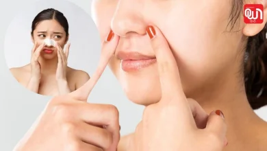 Blackheads Home Remedies