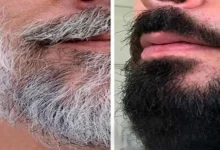 White beard turn black naturally