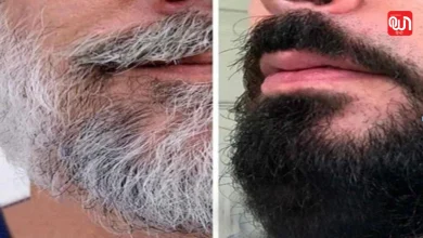 White beard turn black naturally: क्या सफेद दाढ़ी फिर से काली हो सकती है? जानिए कारण और प्राकृतिक उपाय 8 White beard turn black naturally