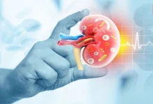 CKD Causes in Young Adults