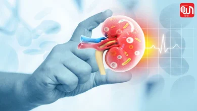 CKD Causes in Young Adults