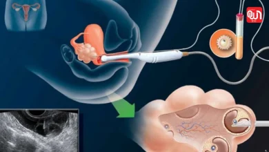 How long does it take to get pregnant through IVF
