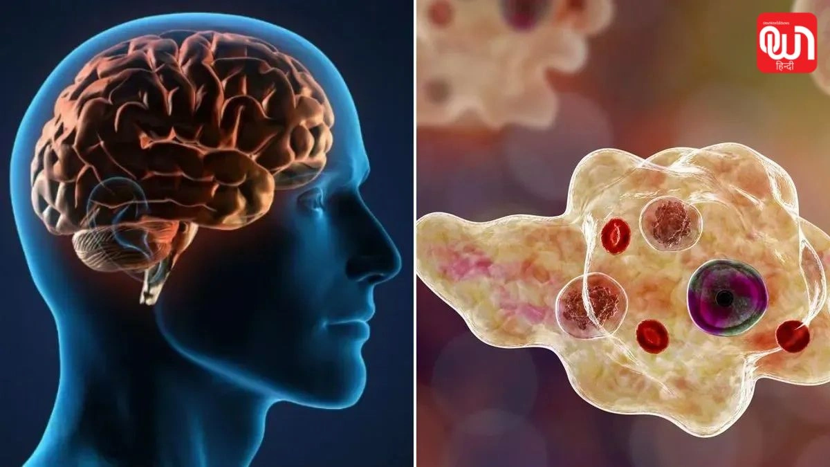 Amoebic symptoms: 20 लोगों की मौत के बाद दहशत, दिमाग पर हमला करता है ये अमीबा, पहचानें लक्षण 1 Amoebic symptoms