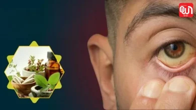 Ayurvedic Medicine For Jaundice