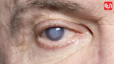 Cataract Symptoms: उम्र के साथ बढ़ता खतरा! जानिए Cataract के लक्षण और बचाव के तरीके 11 Cataract Symptoms