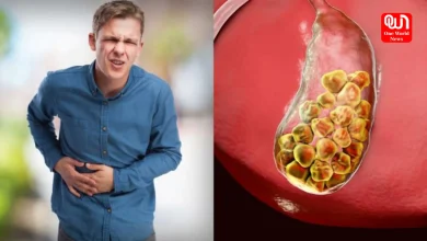 Main Causes of Gallstones