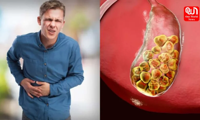 Main Causes of Gallstonesबनने के पीछे के कारण और इसे रोकने के उपाय 1 Main Causes of Gallstones