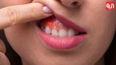 Mouth Cancer Signs: 2 हफ्ते से ज्यादा न भरे छाले तो हो जाएं सावधान! तुरंत कराएं जांच 8 Mouth Cancer Signs