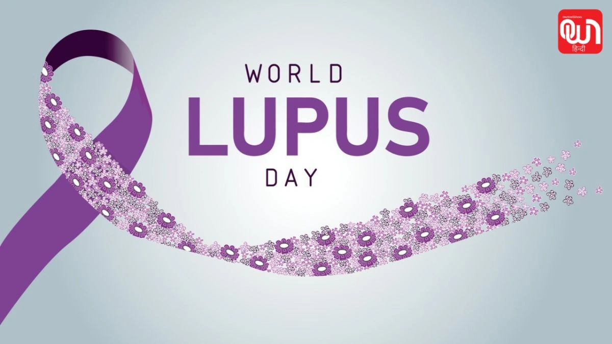 World Lupus Day 2026: ल्यूपस डे 2026, महिलाओं में तेजी से बढ़ रही इस बीमारी को पहचानें समय पर 1 World Lupus Day 2026