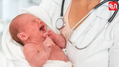 Children Deaths Due To Measles: बच्चों के लिए खतरा, खसरे से कैसे बचें और फैलने से रोकें? 4 Children Deaths Due To Measles