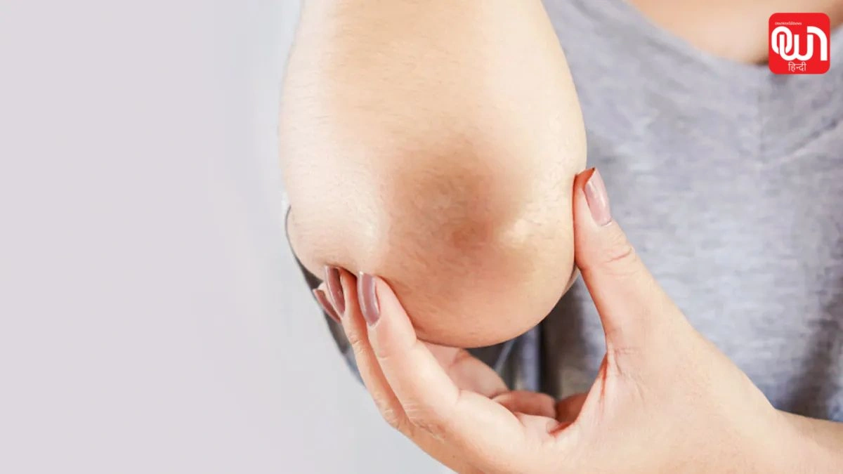 Dark Elbows Remedy: ₹2 की चीज से कोहनियों का कालापन मिटाएं और स्किन चमकाएं 1 Dark Elbows Remedy