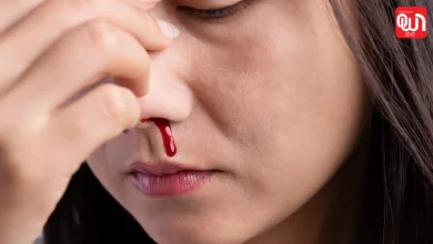 Nose bleeding causes