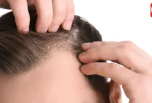 Anti-Dandruff Shampoo: घर में रखा खट्टा दही बालों के लिए है वरदान, जानें कैसे करें इस्तेमाल 19 Anti-Dandruff Shampoo