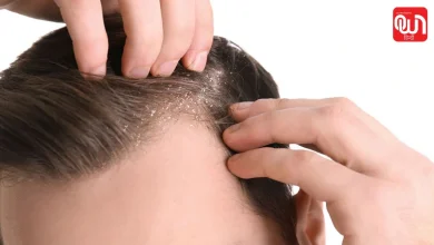 Anti-Dandruff Shampoo
