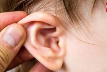Fior Ear Infection
