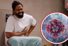 Norovirus