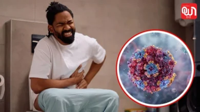 Norovirus