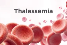 Thalassemia