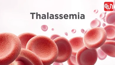 Thalassemia