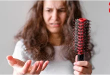 Hair Fall