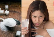 Hiccups Remedies