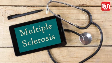 Multiple Sclerosis Warning: 20 से 40 साल के लोग रहें सतर्क! शरीर के ये संकेत हो सकते हैं Multiple Sclerosis का इशारा 20 Multiple Sclerosis Warning