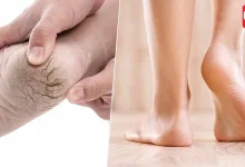 Summer Foot Care Tips