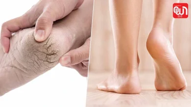 Summer Foot Care Tips