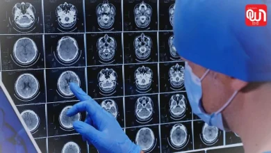World Alzheimer's Month 2026
