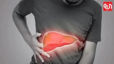 Fatty Liver
