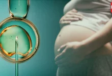 IVF Treatment