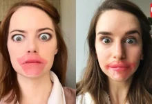 Lip Masks Side Effects