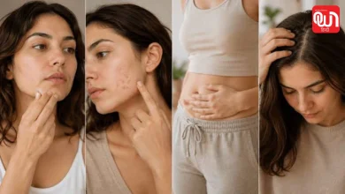 PMOS Symptoms: महिलाएं भूलकर भी न करें नजरअंदाज ये लक्षण, हो सकती है PCOS की शुरुआत 98 PMOS Symptoms