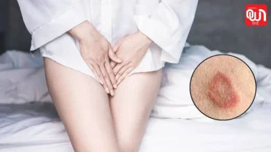 प्राइवेट पार्ट में पसीने से बढ़ रही है खुजली? जानिए Skin Infection के लक्षण और इलाज 8 Skin Infection