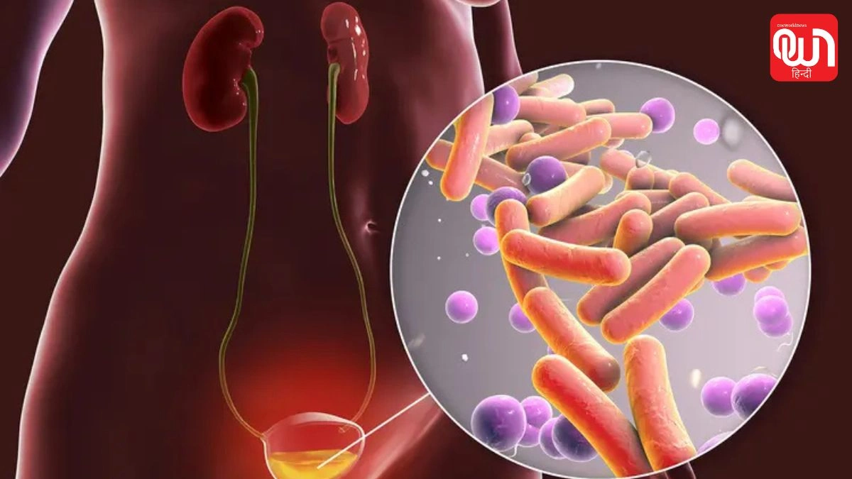 Urinary Tract Infection: क्या आपको भी बार-बार आ रहा है पेशाब? भूलकर भी न करें इग्नोर, हो सकती हैं ये गंभीर बीमारियां 1 Urinary Tract Infection