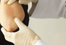 World Psoriasis Day 2026